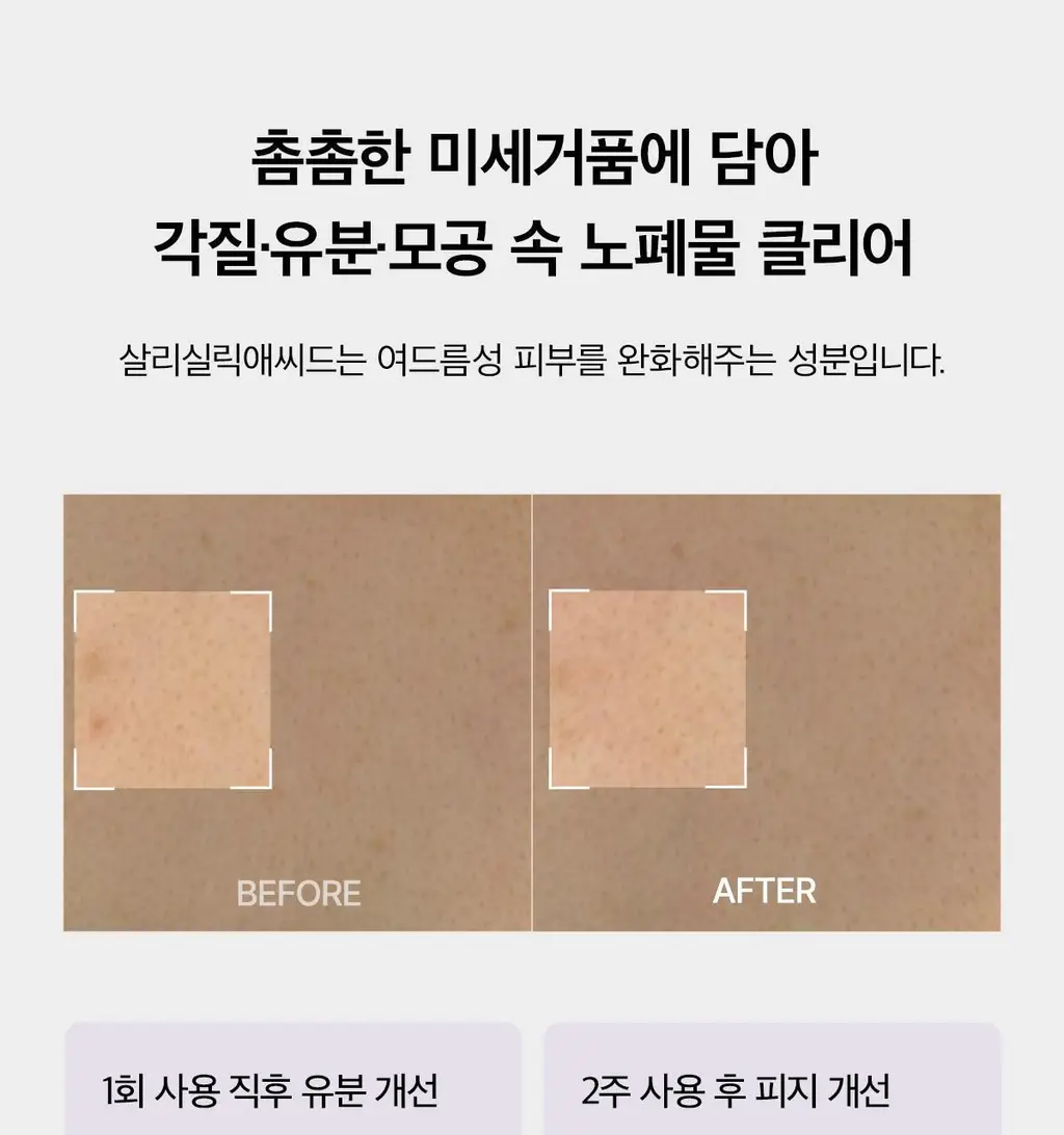 [5월 올영픽/포켓몬 에디션]포맨트 아크네 퍼퓸샤워 코튼허그 500ml(+바디워시30ml) 상세페이지 12